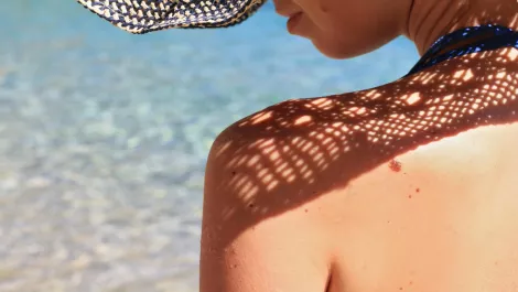 Summer, sun and... skin cancer? This new app might just save your life